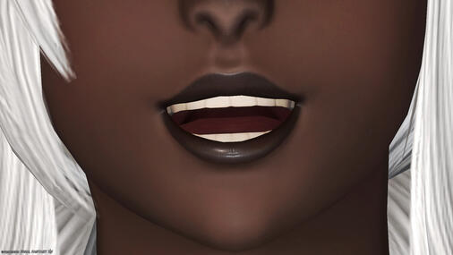 Open Mouth